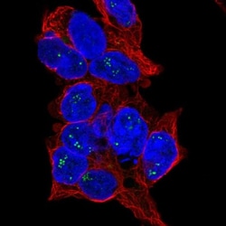 CCDC4 Antibody, Novus Biologicals 25 &mu;L; Unlabeled:Antibodies, Polyclonal